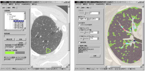 医用画像処理の様子（画像）